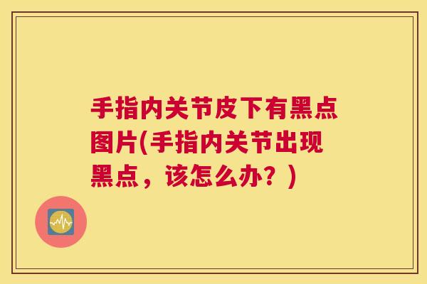 手指内关节皮下有黑点图片(手指内关节出现黑点,该怎么办?)