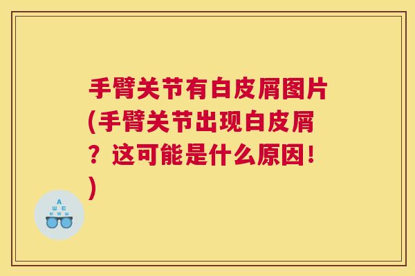 手臂关节有白皮屑图片(手臂关节出现白皮屑?这可能是什么原因!)