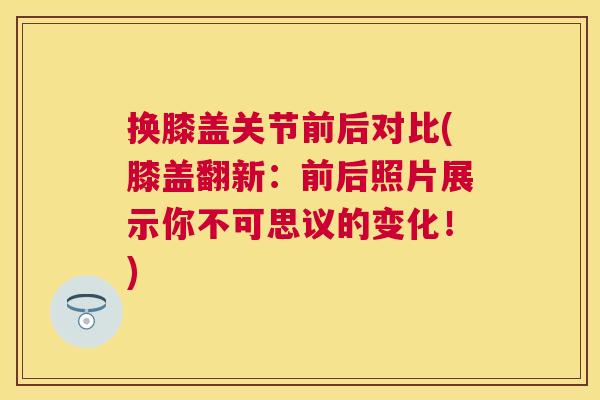 换膝盖关节前后对比(膝盖翻新:前后照片展示你不可思议的变化!)