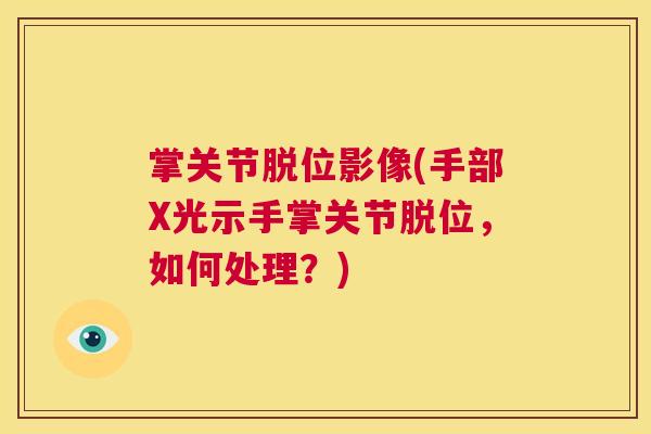 掌关节脱位影像(手部X光示手掌关节脱位,如何处理?)
