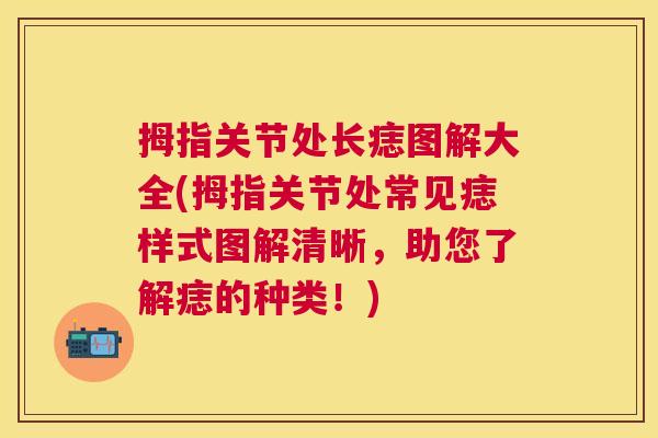 拇指关节处长痣图解大全(拇指关节处常见痣样式图解清晰,助您了解痣的种类!)