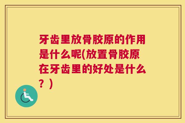 牙齿里放骨胶原的作用是什么呢(放置骨胶原在牙齿里的好处是什么?) 牙齿里放骨胶原的作用是什么呢(放置骨胶原在牙齿里的好处是什么?)