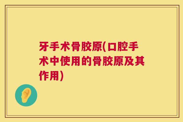 牙手术骨胶原(口腔手术中使用的骨胶原及其作用) 牙手术骨胶原(口腔手术中使用的骨胶原及其作用)