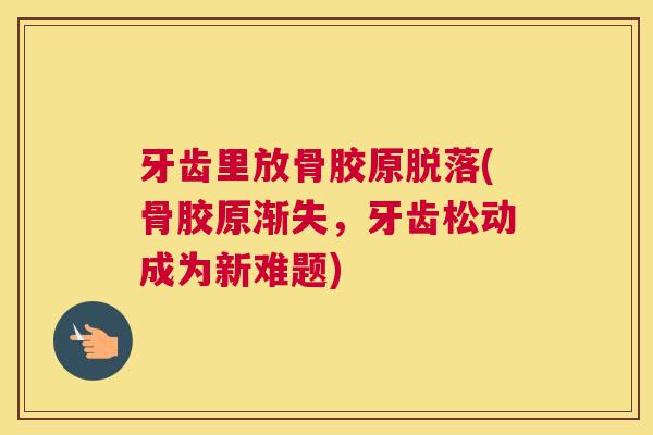 牙齿里放骨胶原脱落(骨胶原渐失，牙齿松动成为新难题)
