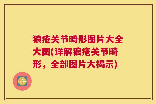 狼疮关节畸形图片大全大图(详解狼疮关节畸形，全部图片大揭示)