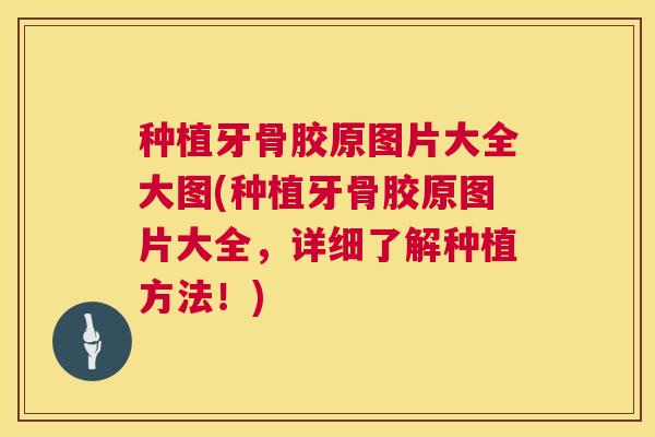 种植牙骨胶原图片大全大图(种植牙骨胶原图片大全，详细了解种植方法！)