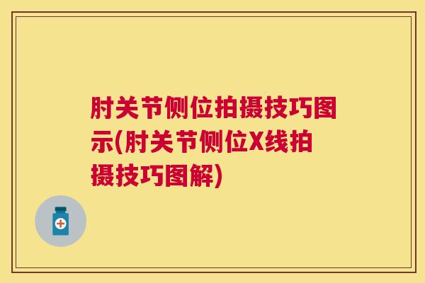 肘关节侧位拍摄技巧图示(肘关节侧位X线拍摄技巧图解) 肘关节侧位拍摄技巧图示(肘关节侧位X线拍摄技巧图解)