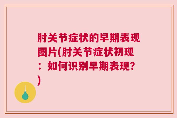 肘关节症状的早期表现图片(肘关节症状初现：如何识别早期表现？)