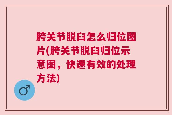 胯关节脱臼怎么归位图片(胯关节脱臼归位示意图,快速有效的处理方法) 胯关节脱臼怎么归位图片(胯关节脱臼归位示意图,快速有效的处理方法)