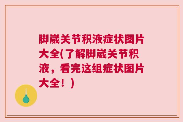 脚崴关节积液症状图片大全(了解脚崴关节积液,看完这组症状图片大全!)