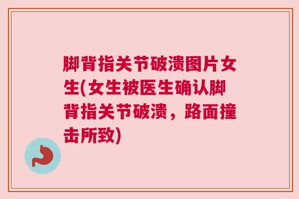 脚背指关节破溃图片女生(女生被医生确认脚背指关节破溃，路面撞击所致)