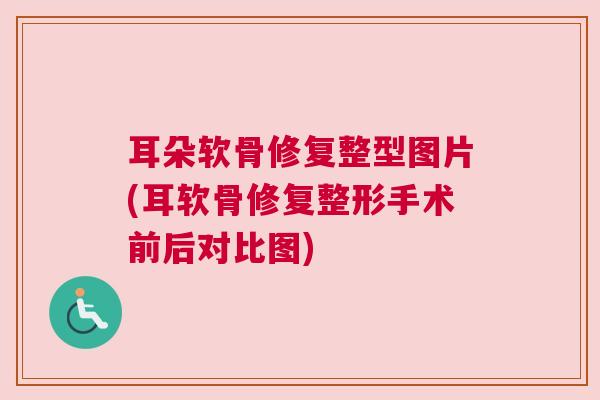 耳朵软骨修复整型图片(耳软骨修复整形手术前后对比图)