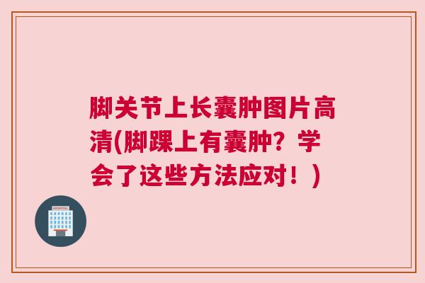 脚关节上长囊肿图片高清(脚踝上有囊肿?学会了这些方法应对!) 脚关节上长囊肿图片高清(脚踝上有囊肿?学会了这些方法应对!)