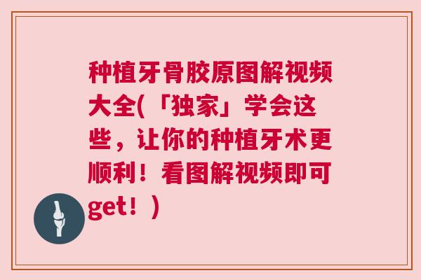 种植牙骨胶原图解视频大全(「独家」学会这些,让你的种植牙术更顺利!看图解视频即可get!)