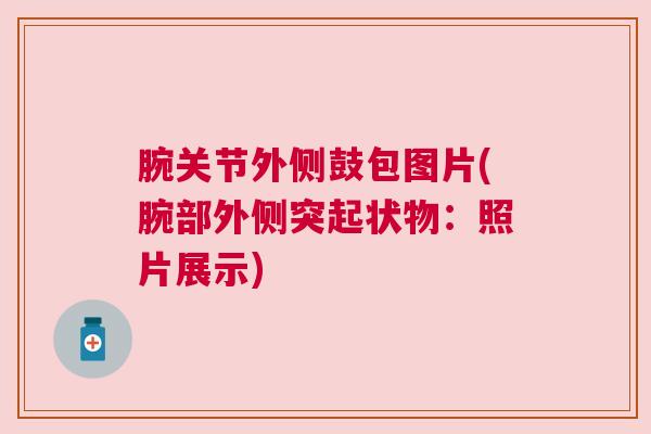 腕关节外侧鼓包图片(腕部外侧突起状物:照片展示)