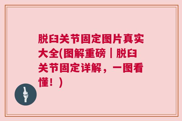 脱臼关节固定图片真实大全(图解重磅|脱臼关节固定详解,一图看懂!)
