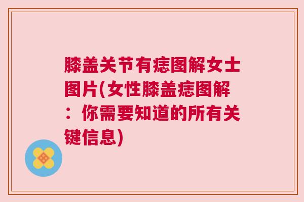 膝盖关节有痣图解女士图片(女性膝盖痣图解：你需要知道的所有关键信息)