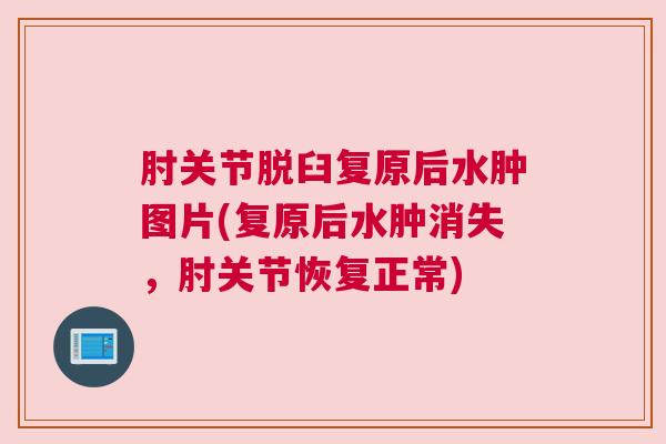 肘关节脱臼复原后水肿图片(复原后水肿消失,肘关节恢复正常) 肘关节脱臼复原后水肿图片(复原后水肿消失,肘关节恢复正常)