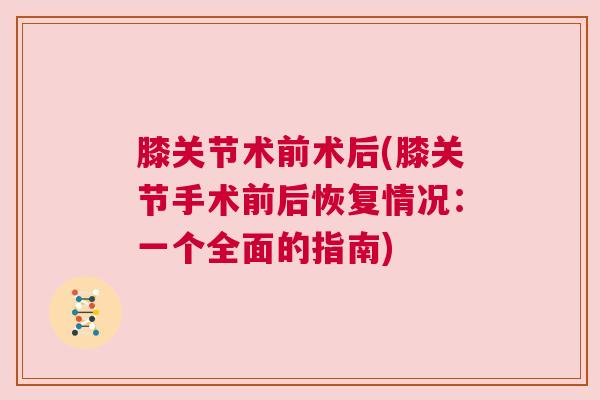 膝关节术前术后(膝关节手术前后恢复情况:一个全面的指南)