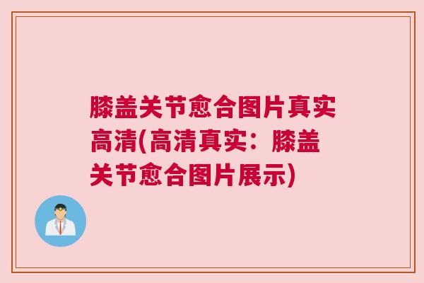 膝盖关节愈合图片真实高清(高清真实:膝盖关节愈合图片展示)