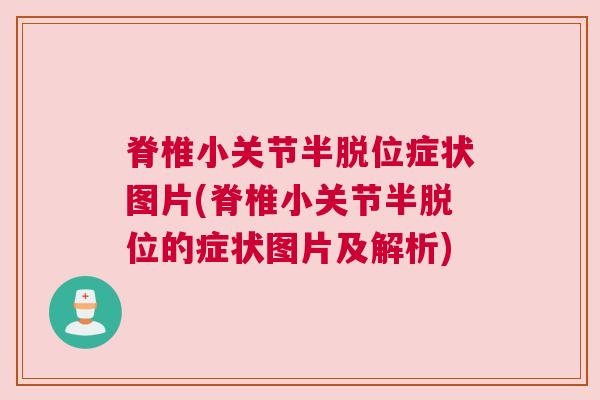 脊椎小关节半脱位症状图片(脊椎小关节半脱位的症状图片及解析)