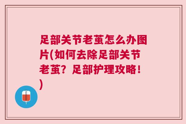 足部关节老茧怎么办图片(如何去除足部关节老茧?足部护理攻略!)