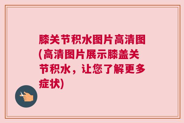 膝关节积水图片高清图(高清图片展示膝盖关节积水,让您了解更多症状)