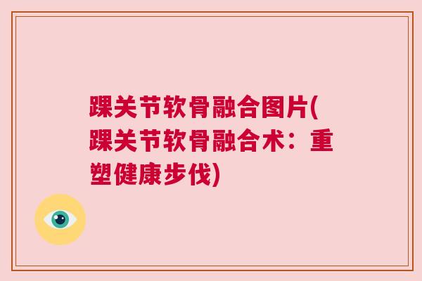 踝关节软骨融合图片(踝关节软骨融合术：重塑健康步伐)