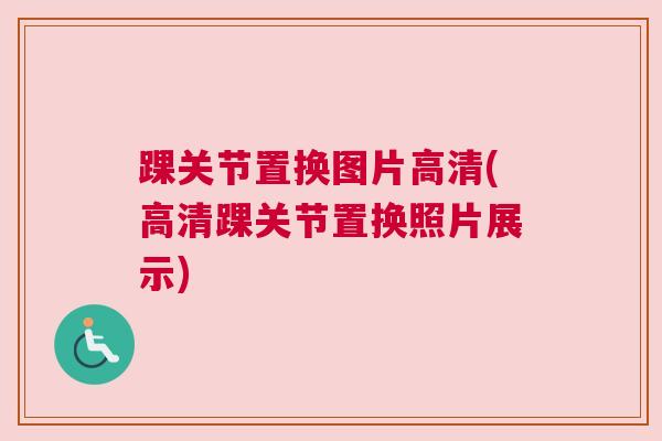 踝关节置换图片高清(高清踝关节置换照片展示)