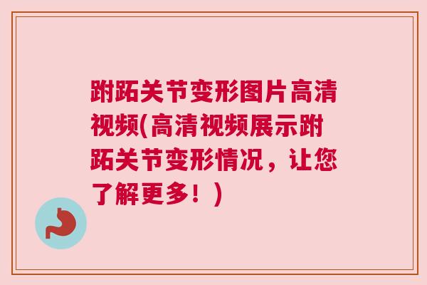 跗跖关节变形图片高清视频(高清视频展示跗跖关节变形情况,让您了解更多!)