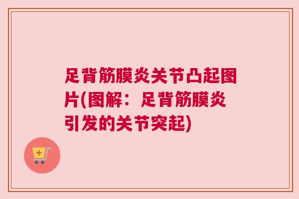 足背筋膜炎关节凸起图片(图解:足背筋膜炎引发的关节突起) 足背筋膜炎关节凸起图片(图解:足背筋膜炎引发的关节突起)