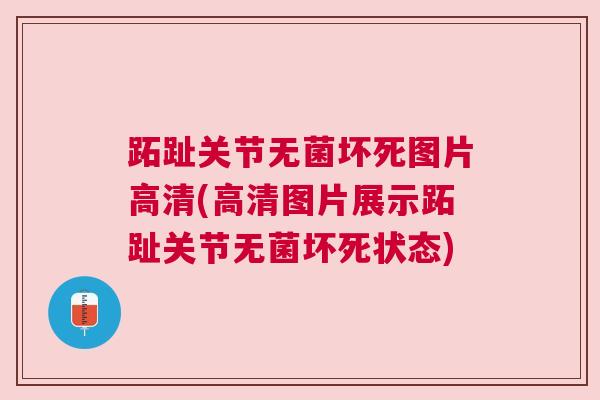 跖趾关节无菌坏死图片高清(高清图片展示跖趾关节无菌坏死状态) 跖趾关节无菌坏死图片高清(高清图片展示跖趾关节无菌坏死状态)