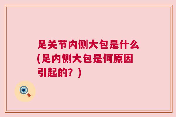 足关节内侧大包是什么(足内侧大包是何原因引起的?)