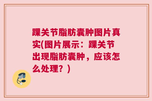 踝关节脂肪囊肿图片真实(图片展示：踝关节出现脂肪囊肿，应该怎么处理？)