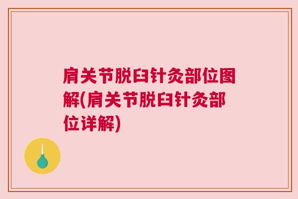 肩关节脱臼针灸部位图解(肩关节脱臼针灸部位详解)
